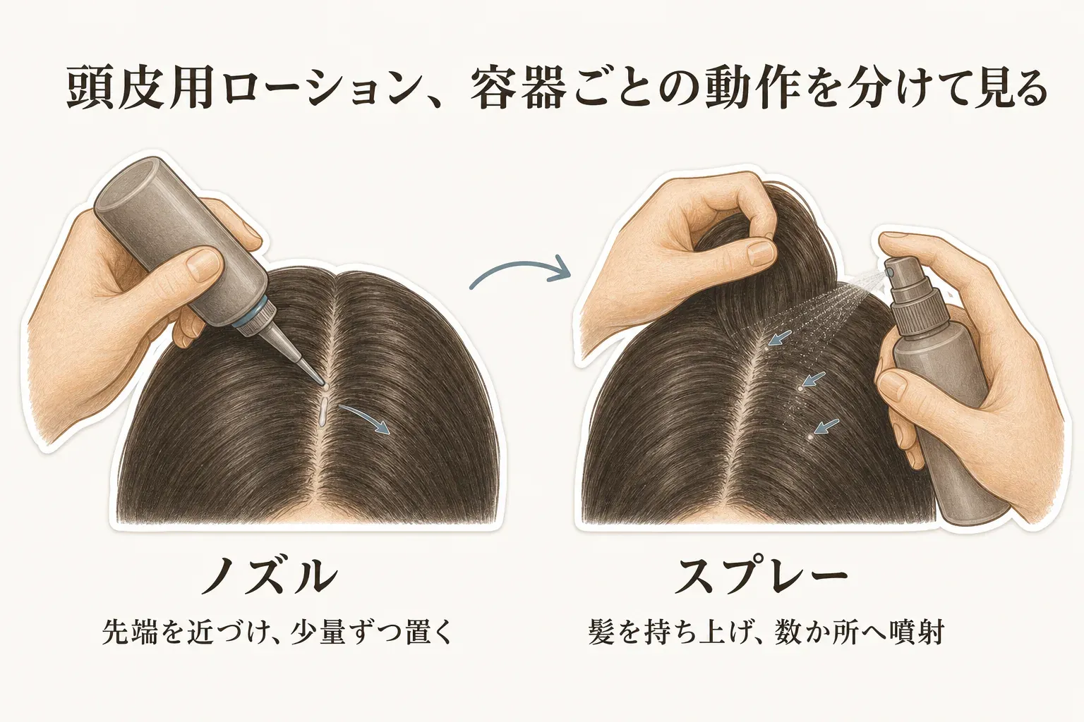 頭皮用ローションの容器ごとの動作を示す図。ノズルは分け目の頭皮へ先端を近づけて少量ずつ置き、スプレーは髪を持ち上げて頭皮の数か所へ噴射する